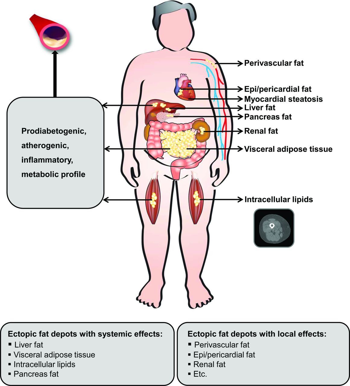 Fat deposits